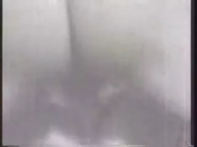 刺穿眉毛的宝贝被撞了